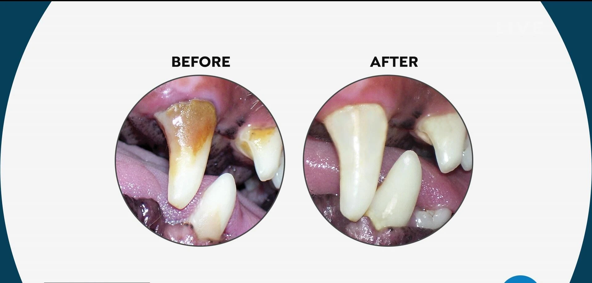 Before-and-after pictures showcasing improved dental health